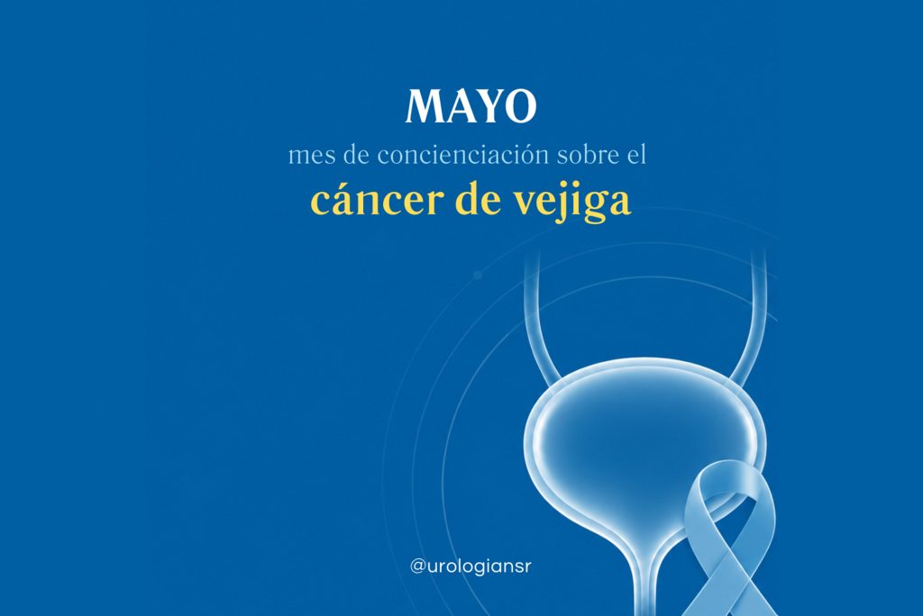 mayo, mes del cáncer de vejiga